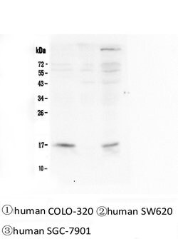 Invitrogen FHIT Monoclonal Antibody (26H7) 100 &mu;g; Unconjugated:Antibodies,
