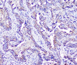 Invitrogen Arylsulfatase A Monoclonal Antibody (4C10) 100 &mu;g; Unconjugated:Antibodies,