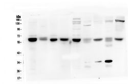 Invitrogen Arylsulfatase A Monoclonal Antibody (4C10) 100 &mu;g; Unconjugated:Antibodies,