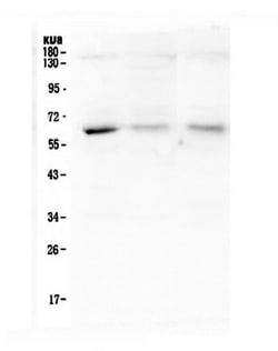 Invitrogen Arylsulfatase A Monoclonal Antibody (4C10) 100 &mu;g; Unconjugated:Antibodies,
