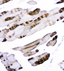 Invitrogen alpha Actinin 3 Monoclonal Antibody (9B5) 100 &mu;g; Unconjugated:Antibodies,
