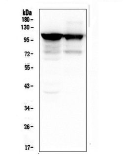 Invitrogen alpha Actinin 3 Monoclonal Antibody (9B5) 100 &mu;g; Unconjugated:Antibodies,