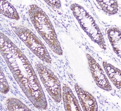 Invitrogen CD2AP Monoclonal Antibody (5F8) 100 &mu;g; Unconjugated:Antibodies,