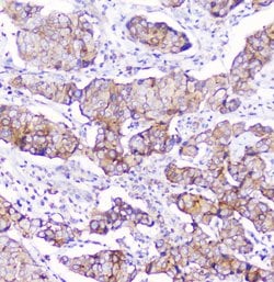 Invitrogen CD2AP Monoclonal Antibody (5F8) 100 &mu;g; Unconjugated:Antibodies,
