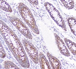 Invitrogen CD2AP Monoclonal Antibody (5F8) 100 &mu;g; Unconjugated:Antibodies,
