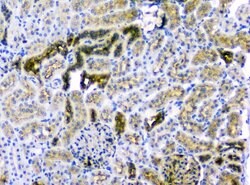 Invitrogen CD2AP Monoclonal Antibody (5F8) 100 &mu;g; Unconjugated:Antibodies,