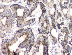 Invitrogen Fumarase Monoclonal Antibody (9D8) 100 &mu;g; Unconjugated:Antibodies,