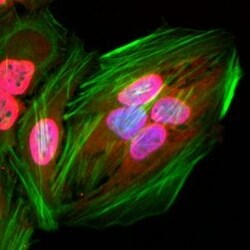 Invitrogen Acetylated Lysine Recombinant Rabbit Monoclonal Antibody (RM101)