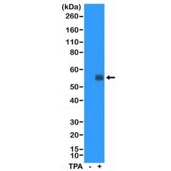 Invitrogen c-Fos Recombinant Rabbit Monoclonal Antibody (RM374) 100 &mu;L;
