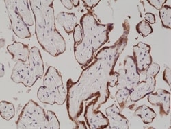 Invitrogen hCG Recombinant Rabbit Monoclonal Antibody (RM330) 100 &mu;L;