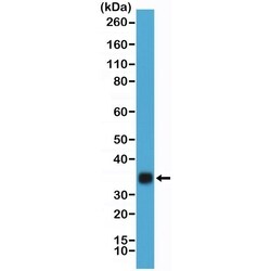 Invitrogen hCG Recombinant Rabbit Monoclonal Antibody (RM330) 100 &mu;L;