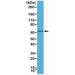Invitrogen Estrogen Receptor alpha Recombinant Rabbit Monoclonal Antibody