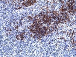 Invitrogen TdT Recombinant Rabbit Monoclonal Antibody (RM379) 100 &mu;L;