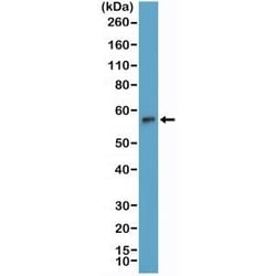 Invitrogen TdT Recombinant Rabbit Monoclonal Antibody (RM379) 100 &mu;L;