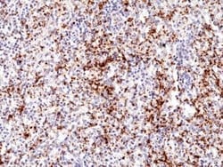Invitrogen CD61 (Integrin beta 3) Recombinant Rabbit Monoclonal Antibody (RM382) 100 &mu;L | Buy Online | Invitrogen&trade; | Fisher Scientific