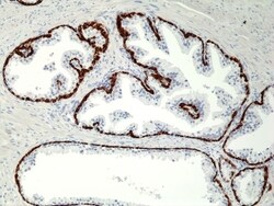 Invitrogen Cytokeratin 5/6 Recombinant Rabbit Monoclonal Antibody (RM341)