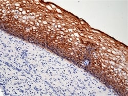 Invitrogen Cytokeratin 5/6 Recombinant Rabbit Monoclonal Antibody (RM341)