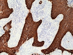 Invitrogen Cytokeratin 5/6 Recombinant Rabbit Monoclonal Antibody (RM341)