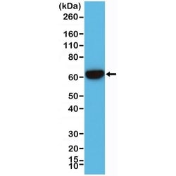 Invitrogen Cytokeratin 5/6 Recombinant Rabbit Monoclonal Antibody (RM341)