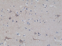 Invitrogen NEFL Recombinant Rabbit Monoclonal Antibody (RM280) 100 &mu;L;