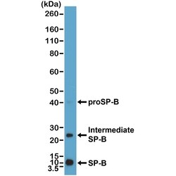 Invitrogen SFTPB Precursor Recombinant Rabbit Monoclonal Antibody (RM370)