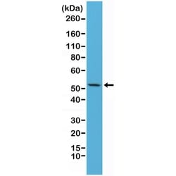 Invitrogen Cytokeratin 7 Recombinant Rabbit Monoclonal Antibody (RM284)