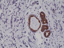 Invitrogen Cytokeratin 7 Recombinant Rabbit Monoclonal Antibody (RM284)