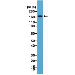 Invitrogen PDGFRB Recombinant Rabbit Monoclonal Antibody (RM303) 100 &mu;L;