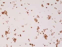 Invitrogen Androgen Receptor Recombinant Rabbit Monoclonal Antibody (RM254) 100 &mu;L | Buy Online | Invitrogen&trade; | Fisher Scientific