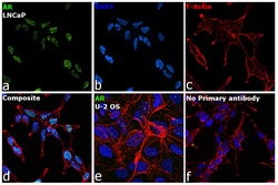 Invitrogen Androgen Receptor Recombinant Rabbit Monoclonal Antibody (RM254) 100 &mu;L | Buy Online | Invitrogen&trade; | Fisher Scientific