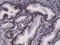 Invitrogen Androgen Receptor Recombinant Rabbit Monoclonal Antibody (RM254) 100 &mu;L | Buy Online | Invitrogen&trade; | Fisher Scientific