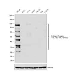 Invitrogen Androgen Receptor Recombinant Rabbit Monoclonal Antibody (RM254) 100 &mu;L | Buy Online | Invitrogen&trade; | Fisher Scientific