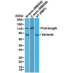 Invitrogen Androgen Receptor Recombinant Rabbit Monoclonal Antibody (RM254) 100 &mu;L | Buy Online | Invitrogen&trade; | Fisher Scientific