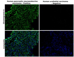 Invitrogen Chromogranin A Recombinant Rabbit Monoclonal Antibody (RM385) 100 &mu;L | Buy Online | Invitrogen&trade; | Fisher Scientific