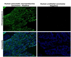 Invitrogen Chromogranin A Recombinant Rabbit Monoclonal Antibody (RM385) 100 &mu;L | Buy Online | Invitrogen&trade; | Fisher Scientific