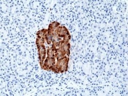 Invitrogen Chromogranin A Recombinant Rabbit Monoclonal Antibody (RM385) 100 &mu;L | Buy Online | Invitrogen&trade; | Fisher Scientific