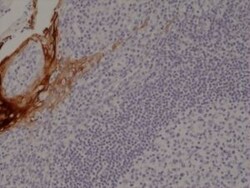 Invitrogen Cytokeratin 4 Recombinant Rabbit Monoclonal Antibody (RM355) 100 &mu;L | Buy Online | Invitrogen&trade; | Fisher Scientific