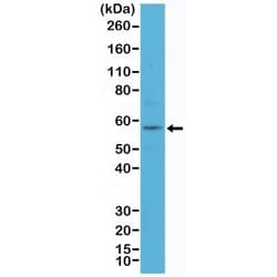 Invitrogen Cytokeratin 4 Recombinant Rabbit Monoclonal Antibody (RM355) 100 &mu;L | Buy Online | Invitrogen&trade; | Fisher Scientific