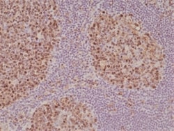 Invitrogen Stathmin 1 Recombinant Rabbit Monoclonal Antibody (RM350) 100