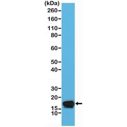 Invitrogen Stathmin 1 Recombinant Rabbit Monoclonal Antibody (RM350) 100