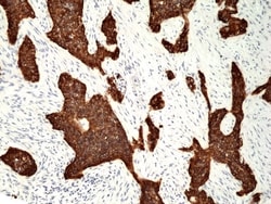 Invitrogen Cytokeratin 5 Recombinant Rabbit Monoclonal Antibody (RM226)