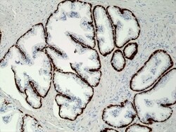 Invitrogen Cytokeratin 5 Recombinant Rabbit Monoclonal Antibody (RM226)