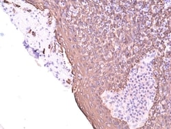 Invitrogen Cytokeratin 5 Recombinant Rabbit Monoclonal Antibody (RM226)