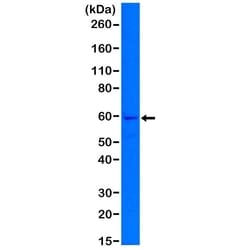 Invitrogen Cytokeratin 5 Recombinant Rabbit Monoclonal Antibody (RM226)