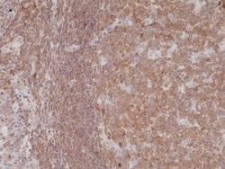 Invitrogen NFkB p50/p105 Recombinant Rabbit Monoclonal Antibody (RM299)
