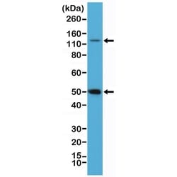 Invitrogen NFkB p50/p105 Recombinant Rabbit Monoclonal Antibody (RM299)