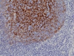 Invitrogen CD21 Recombinant Rabbit Monoclonal Antibody (RM372) 100 &mu;L;