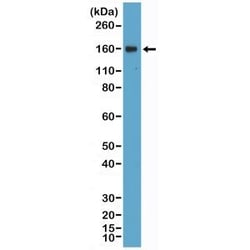 Invitrogen CD21 Recombinant Rabbit Monoclonal Antibody (RM372) 100 &mu;L;