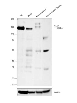 Invitrogen CD21 Recombinant Rabbit Monoclonal Antibody (RM372) 100 &mu;L;