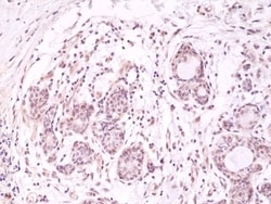 Invitrogen AKT1 (PH domain) Recombinant Rabbit Monoclonal Antibody (RM316)